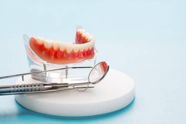 Best Veneers and Lumineers  in Cedar Ridge, CA